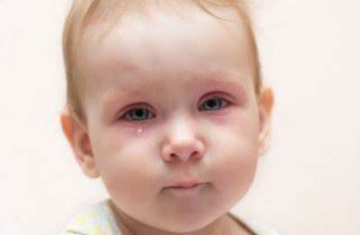 علت آبریزش چشم در نوزادان چیست؟/ love magazine